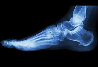 Pathologie musculaire Montreuil Pathologie musculaire Montreuil