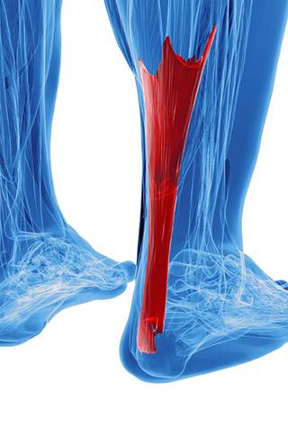 Tendinopathie d'achille Montreuil Tendinopathie d'achille Montreuil